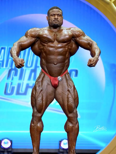 Szoboszlai任意球破门助球队取胜，曼联双线告捷，